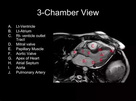 Cardiac mri slice anatomy – Artofit