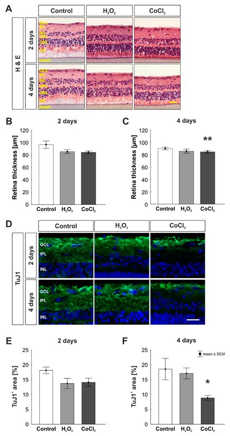 Hypoxic Processes Induce Complement Activation via Classical Pathway in ...