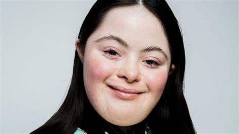 Meet Ellie Goldstein, the model in Gucci Beauty’s latest campaign ...