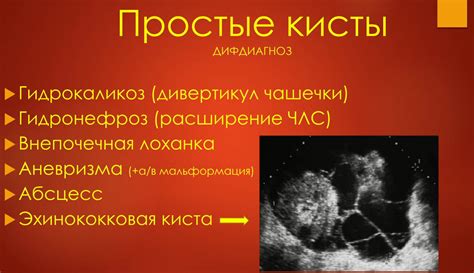 УЗИ диагностика кист почек. Лекция для врачей