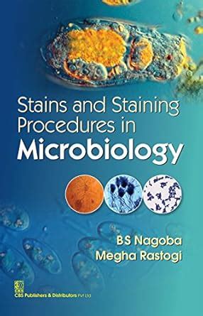Stains and staining Procedures in Microbiology eBook : Nagoba, BS ...
