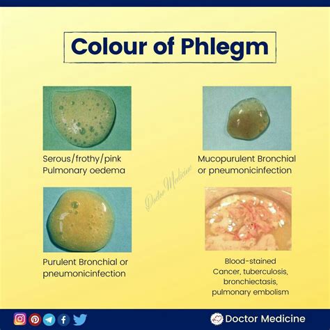 Understanding Sputum Colors