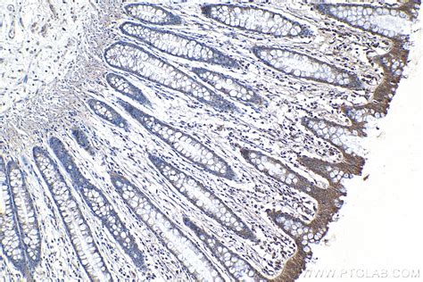 IHCeasy CERCAM Ready-To-Use IHC Kit KHC1280 | Proteintech