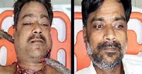Karnataka Man Gets Impaled In Neck By 2ft Tree Branch In Freak Accident ...