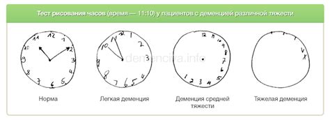 Тесты на деменцию в картинках с ответами - Фото подборки