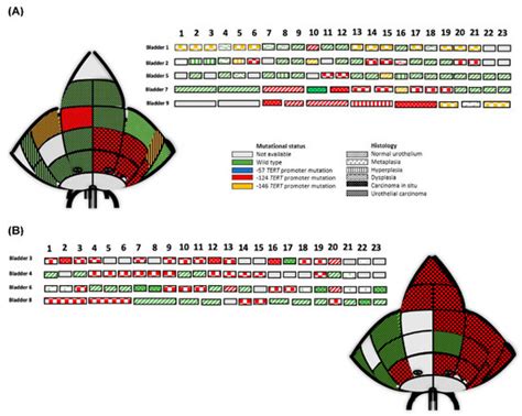 TERT Promoter Mutation Analysis of Whole-Organ Mapping Bladder Cancers