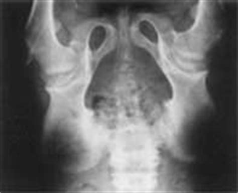 Indian Pediatrics - Editorial