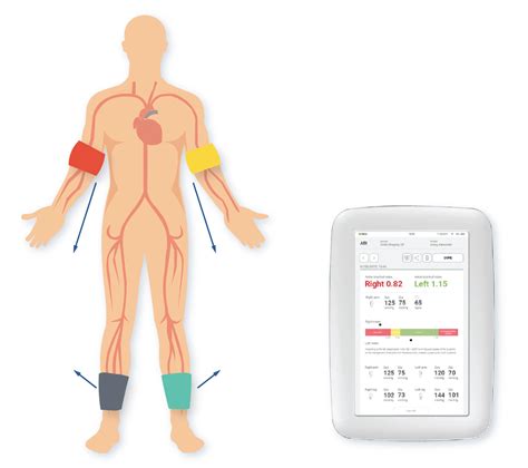 Ankle-Brachial Index Procedures Using Unit IX 的图像结果