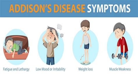 Addison’s Disease: Symptoms, Causes, Diagnosis and Treatment – NutritionFact.in