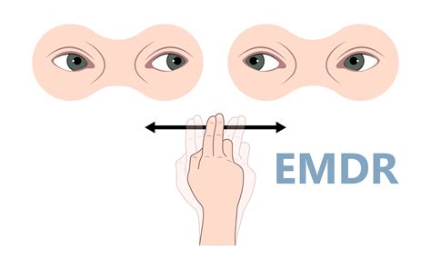 ДПДГ ( EMDR): что это, техника, как работает терапия | РБК Life