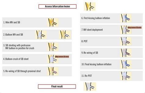 Double kissing crush bifurcation stenting: step-by-step troubleshooting - EuroIntervention
