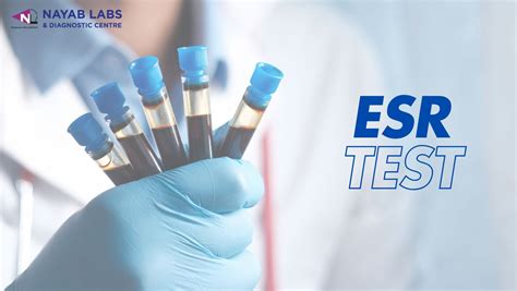 ESR Testing 的图像结果