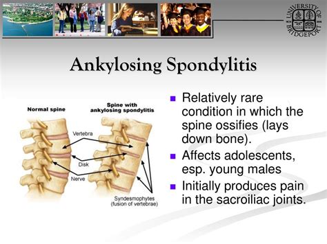Thoracic Spine Orthopedics DX ppt download