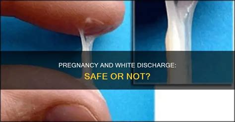 Pregnancy And White Discharge: Safe Or Not? | ShunChild