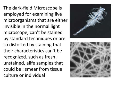 SOLUTION: Dark field microscopy - Studypool