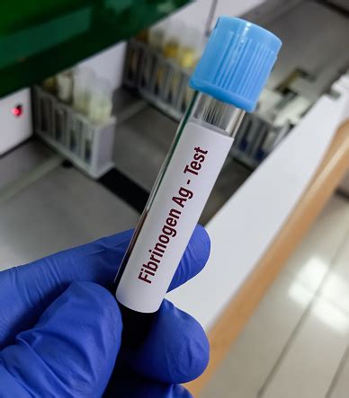 Image result for Fibrinogen Test Procedure
