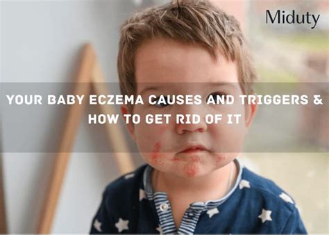 Your Baby Eczema Causes and Triggers & How to Get Rid Of It - Miduty