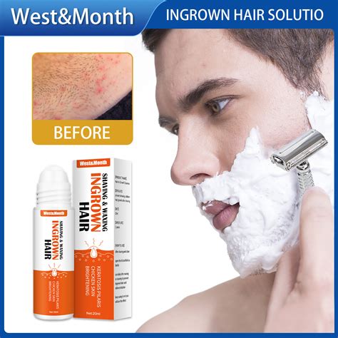 West Month After Shave Repair Serum Prevent Skin Repair Shaving Wax Ingrown Hair Cream Ingrown ...