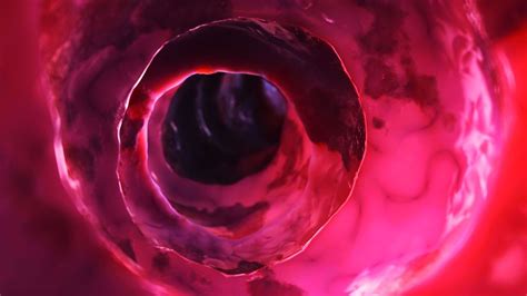 Kardiale Transthyretin-Amyloidose durch neue Therapieoption behandelbar ...