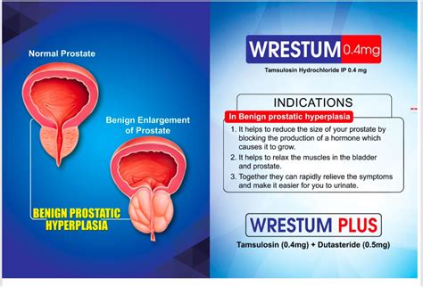Buy Online UROLOGY PRODUCT - Wrest Healthcare Private Limited
