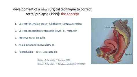 Rectal prolapse: Do we really have a perfect surgical solution? pptx copy | PPTX