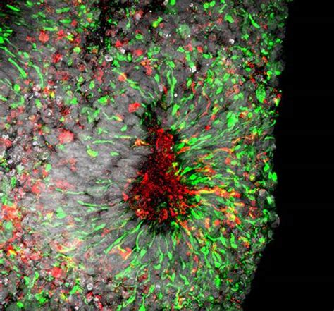 Scientists screen existing drugs in hopes of fast-tracking Zika ...