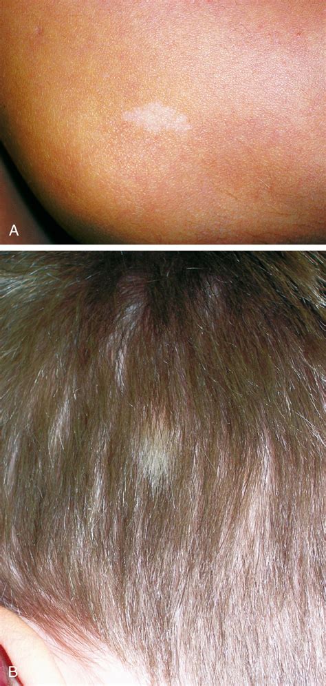 Neurology - Clinical Tree