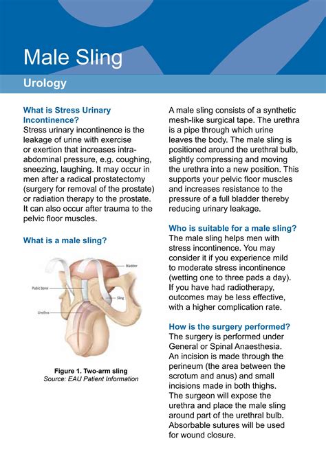 Advance Sling For Incontinence