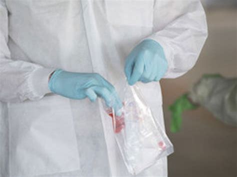 Why does a single patient sample have to be sent back to the SSG Corona ...