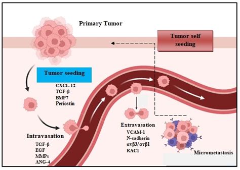Breast Cancer Metastasis To Lung And Brain Life Expectancy at Norma Taylor blog