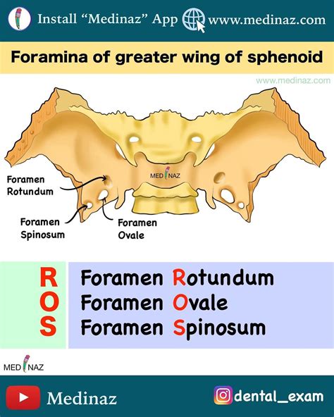 Greater Wing Of Sphenoid Anatomy And Diseases Of The Greater Wings Of