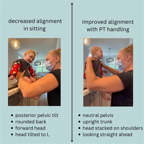 Image result for Normal Leg Alignment