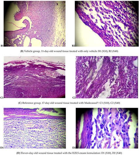 Topical Emulsion Containing Lavandula stoechas Essential Oil as a ...