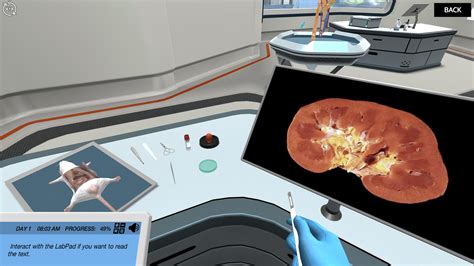 Renal Physiology: Find the mode of action of a diuretic drug | Labster ...
