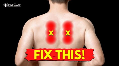 Muscle Spasm Shoulder Blade Treatment