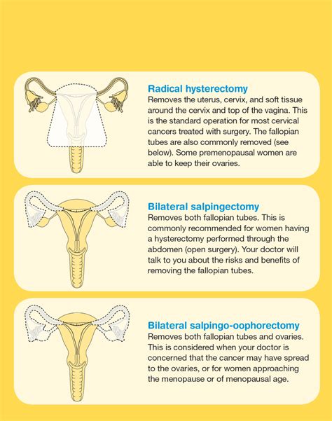 Cervical Cancer Surgery