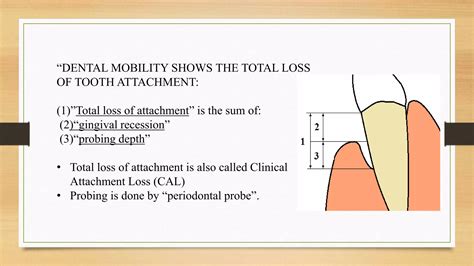 Mobility Classification Teeth