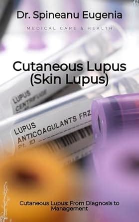Cutaneous Lupus: From Diagnosis to Management eBook : Eugenia, Dr ...