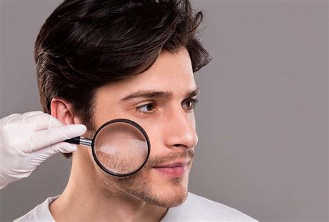 The Best Acne Treatments In India (2022)