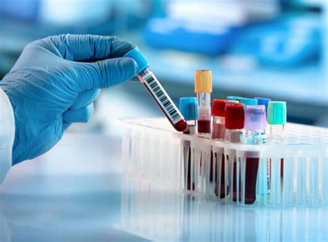 Biochemistry Laboratory - Apollo Cancer Centres