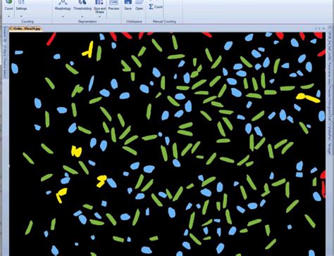 Image result for Object Counting Using Image Processing Python Give Some Input Images