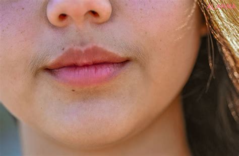 Dark Lips : Causes & Remedies Explained – ALANNA