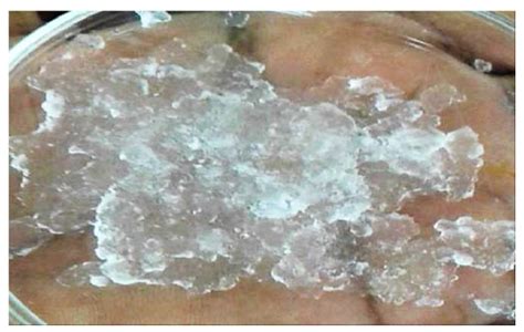 Synthesis of a Cellulose-Co-AMPS Hydrogel for Personal Hygiene ...