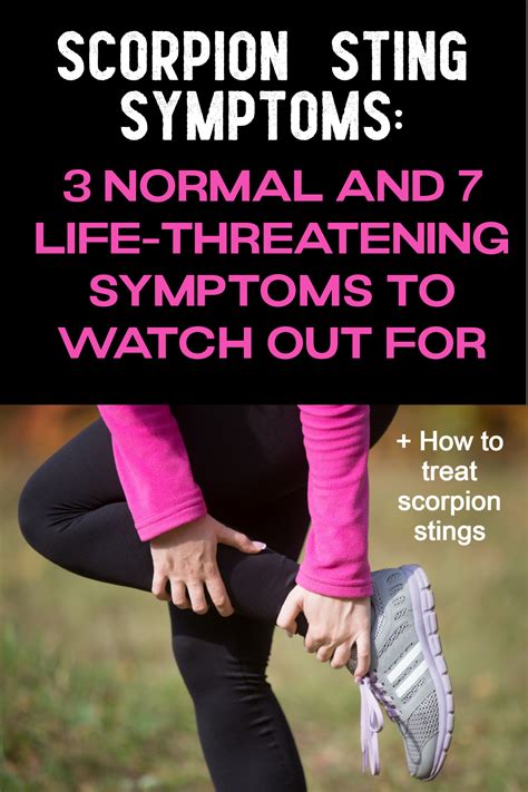 How to easily treat a scorpion sting at home – Natural Upkeep