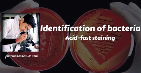 Image result for Acid-Fast Staining Method