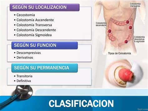 COLOSTOMIA - TECNICA QUIRURGICA E INSTRUMENTAL