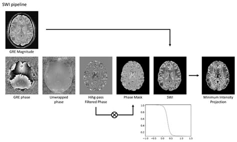 Susceptibility-Weighted Imaging (SWI): Technical Aspects and ...