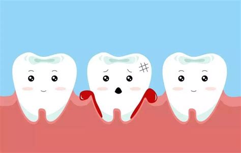 廊坊牙龈经常出血是怎么回事，该怎么办？ - 知乎