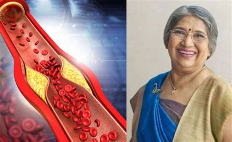 बॉडी से गंदे कोलेस्ट्रॉल को खत्म कर सकती हैं ये 6 हर्ब्स, Dr. Hansaji ...