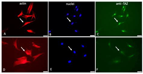 IJMS | Special Issue : Molecular Mechanism in Epithelial-Mesenchymal ...